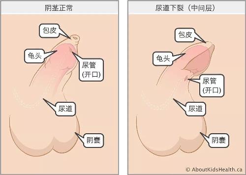 健康報(bào) 男性無法站著排尿？1.jpg