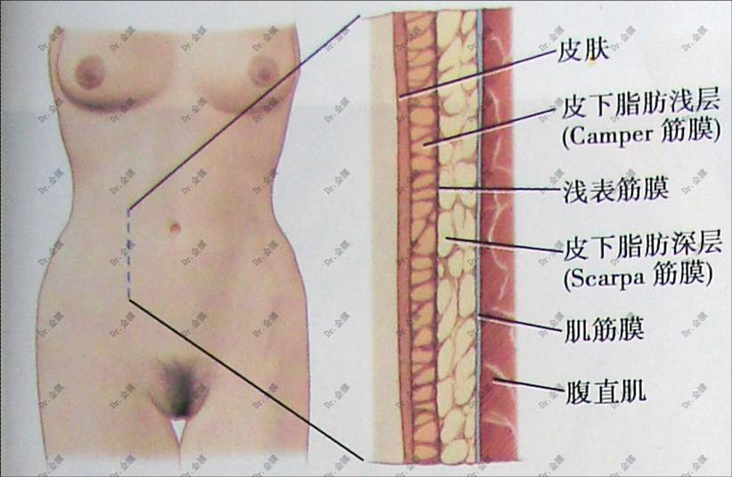 金驥  剖腹產(chǎn)瘢痕 圖片4.jpg