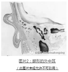 微信 小耳福音：我院開展耳廓整形+聽力重建一站式手術(shù)治療2.jpg